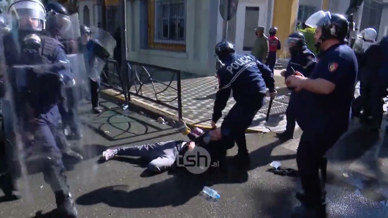 Protesta në Tiranë, 21-vjecari nën monitorimin e neurokirurgëve/Trauma: Nuk ka indikacion për ndërhyrje kirurgjikale, as rrezik për paralizë