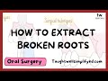 4 ways to extract broken root tips and when to LEAVE THEM ALONE @mentaldental @DentalDigest