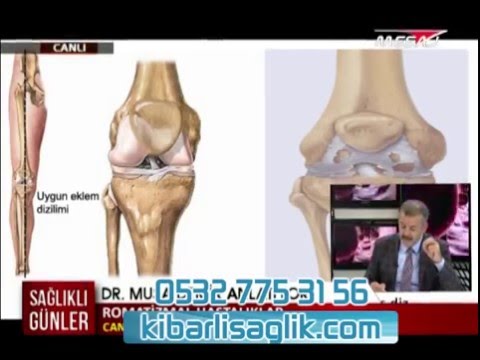 Kalcaneális bursitis