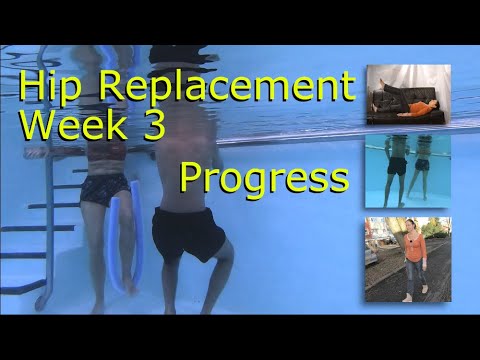 Hip Replacement Week 3 -  Real Progress