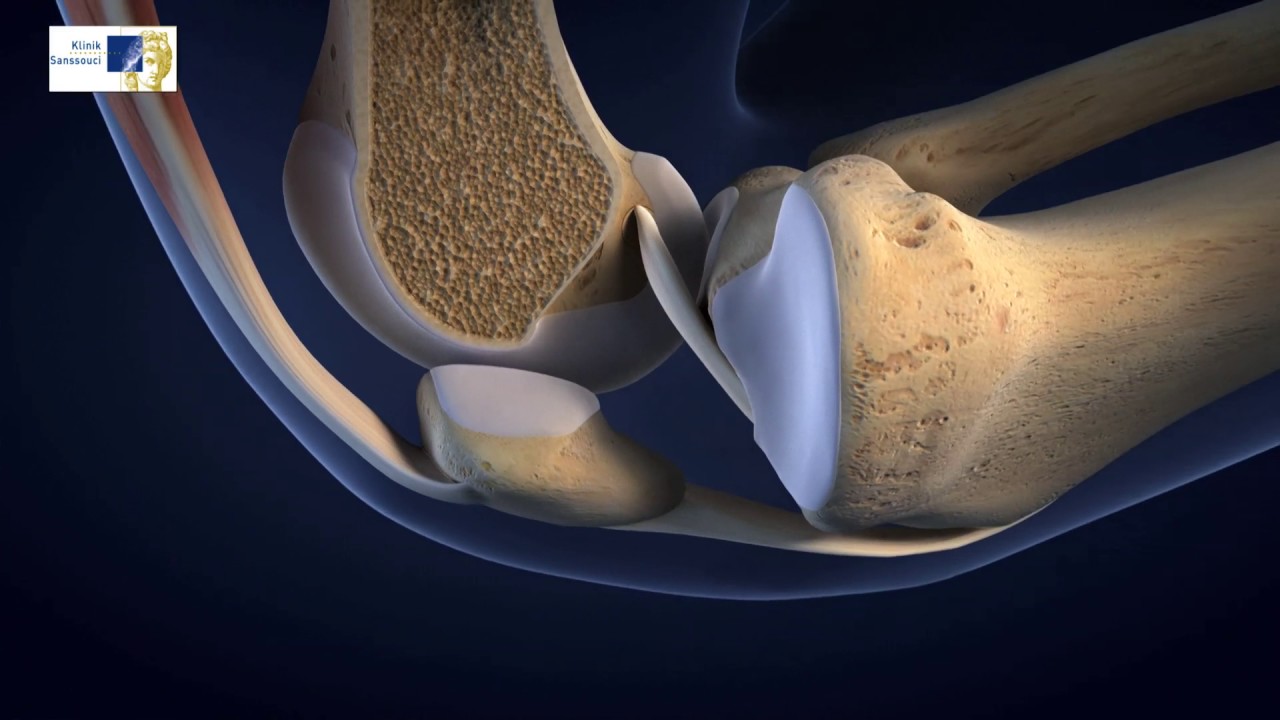 Carsten Schlünsen-4