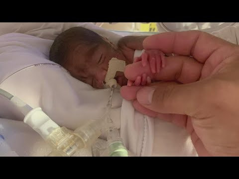 Tiny miracle: Baby born 18 weeks early is home for the holidays