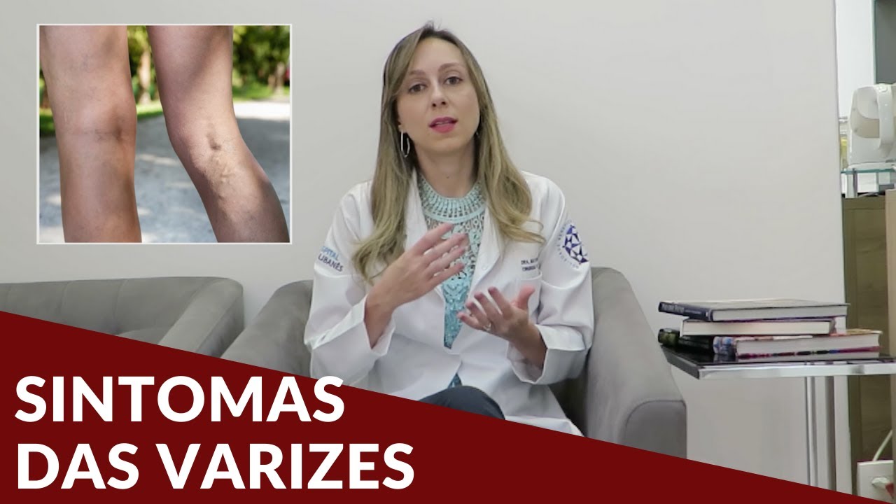 Quais são os sintomas das varizes? - Dra. Nayara Cioffi Batagini