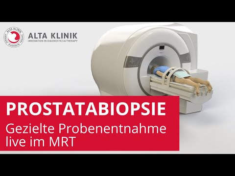 Vostanovlenie nach Prostata-Operation BPH ist eine Laparoskopie