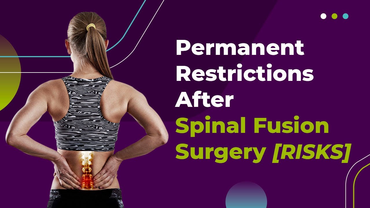 Permanent Restrictions After Spinal Fusion Surgery [RISKS]