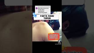 Download lagu Bahu turun #exercise #aclrecovery mp3 Download lagu Bahu turun #exercise #aclrecovery mp3