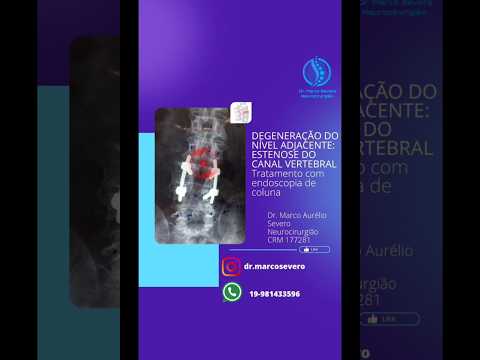 Marco Aurélio Severo Da Silva Versiani-85