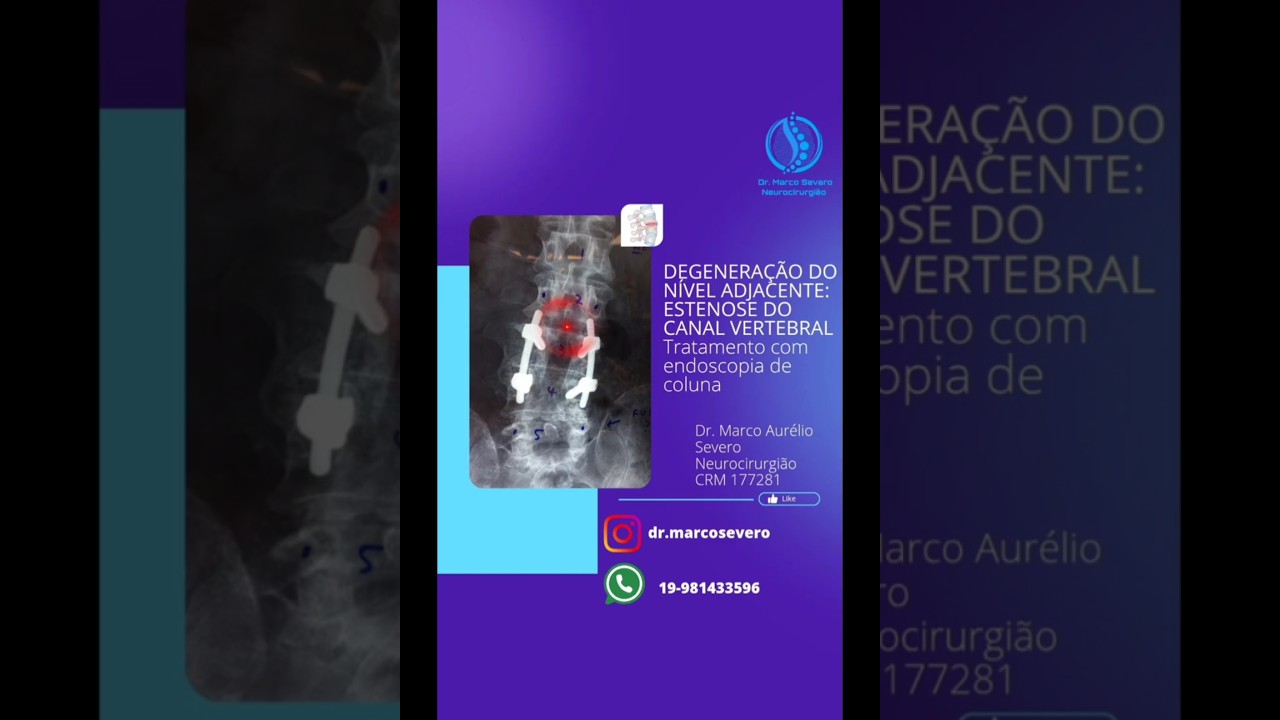 Marco Aurélio Severo Da Silva Versiani-85