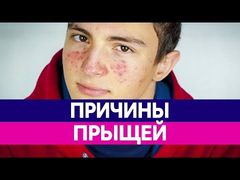 Геркулес для отбеливания кожи Самое эффективные средства для отбеливания кожи лица