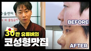 30만 유튜버 코성형맛집 방문기ㅣ남자코성형ㅣ코성형후기ㅣ성형브이로그