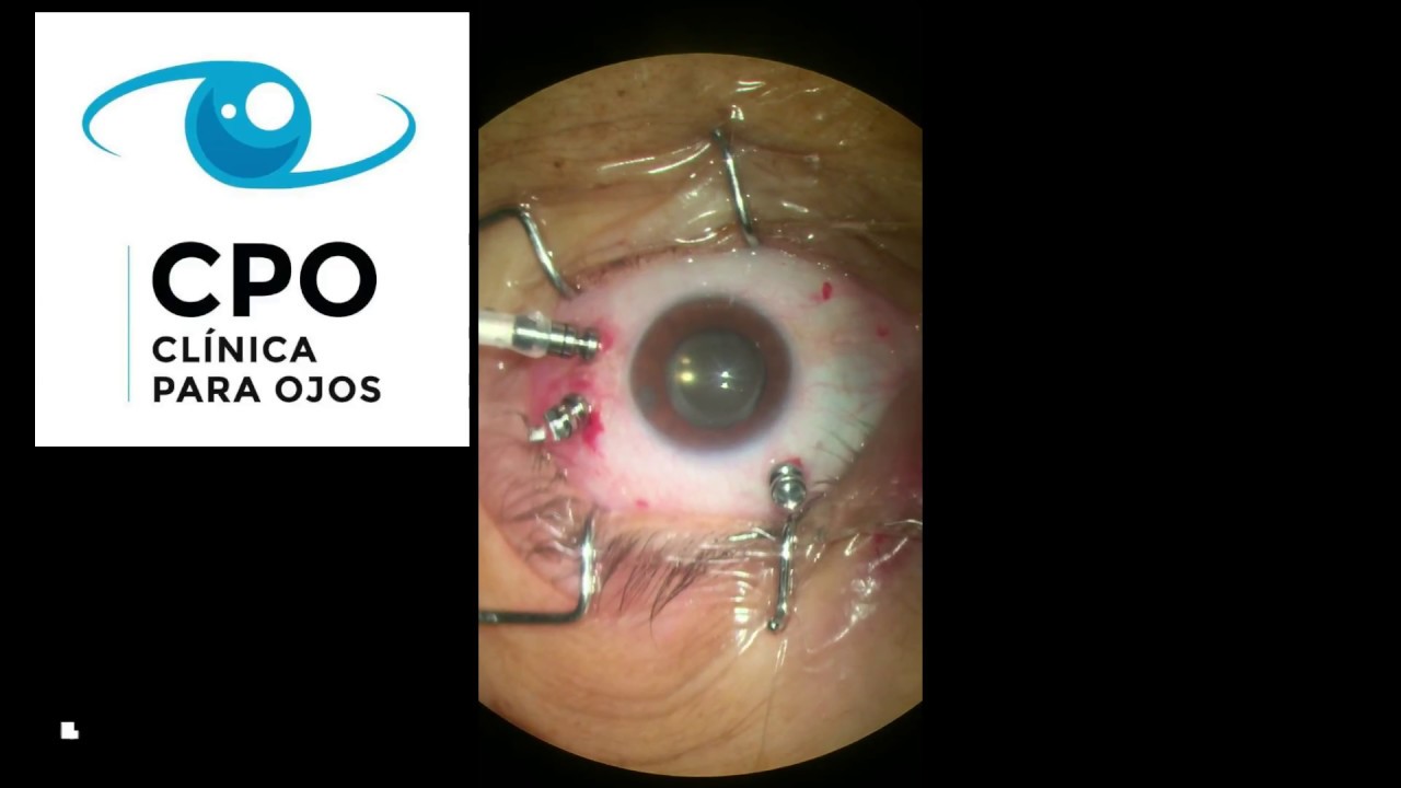 Josue Rangel Servin-10