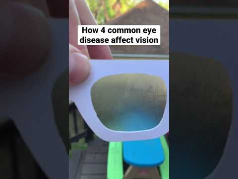 Eye Diseases Vision Simulation