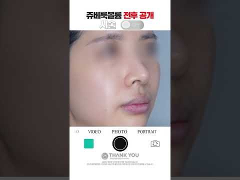 땡큐성형외과 Clips