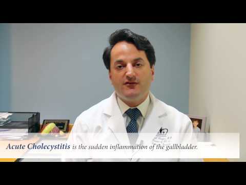 Symptoms of Gallstones