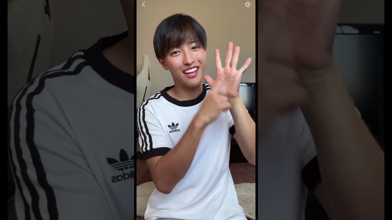 【二重整形】一年経ったよ！安定した！#shorts