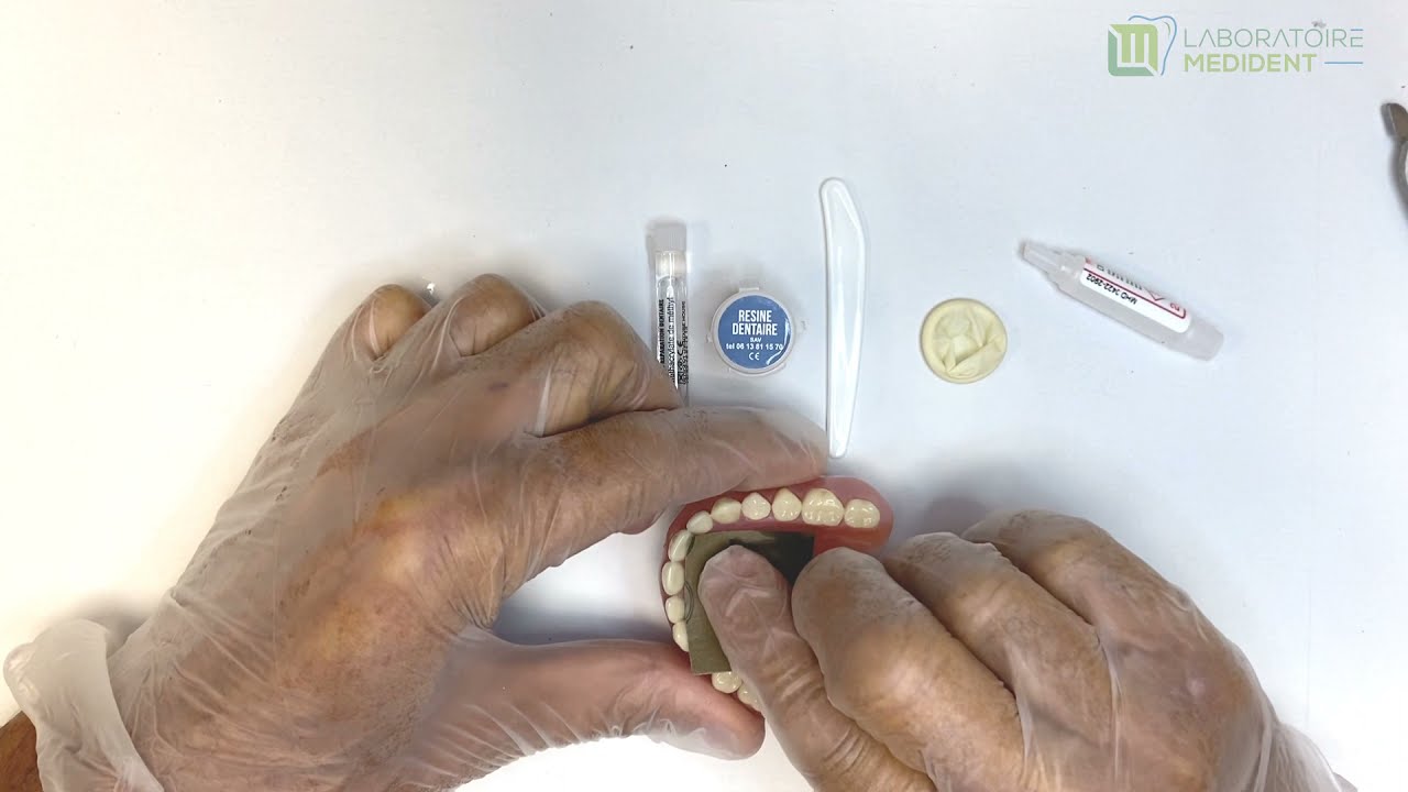 Comment réparer un dentier cassé avec le kit sos medident