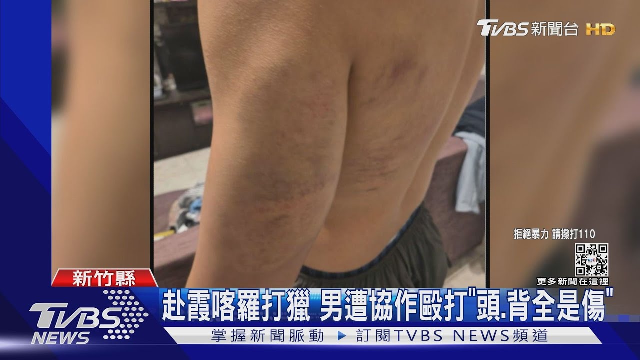 赴霞喀羅打獵 男遭協作毆打「頭、背全是傷」