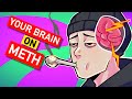 Your brain On Methamphetamine