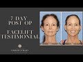 Amazing 7 Day Post Op Facelift Results | Dr Kevin Sadati