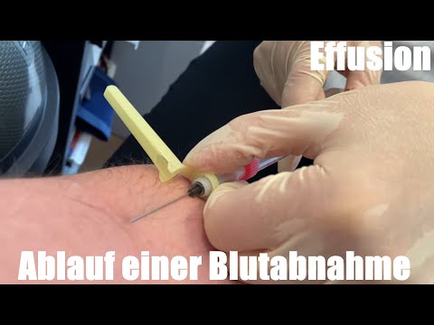 Procedure for taking a blood sample (effusion) from the crook of the arm for a blood count at the...