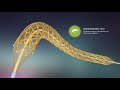 Drug Eluting Stent & Drug Coated Balloon | Concept Medical Products