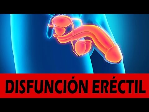 Farmaci BPH Il video massaggio prostatico