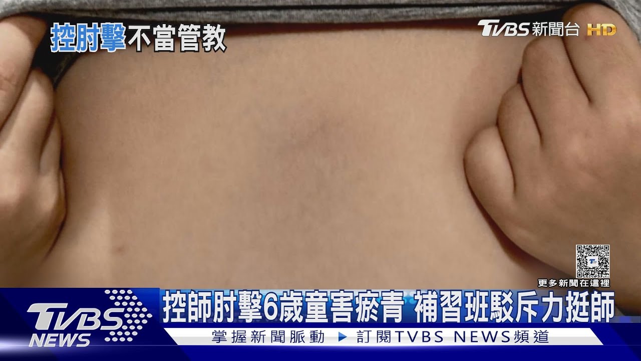 6歲童胸口瘀青! 家長怒控補習班師肘擊 業者力挺師