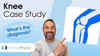 Knee Pain Case Study | Expert Physio Explains Really Important Case!