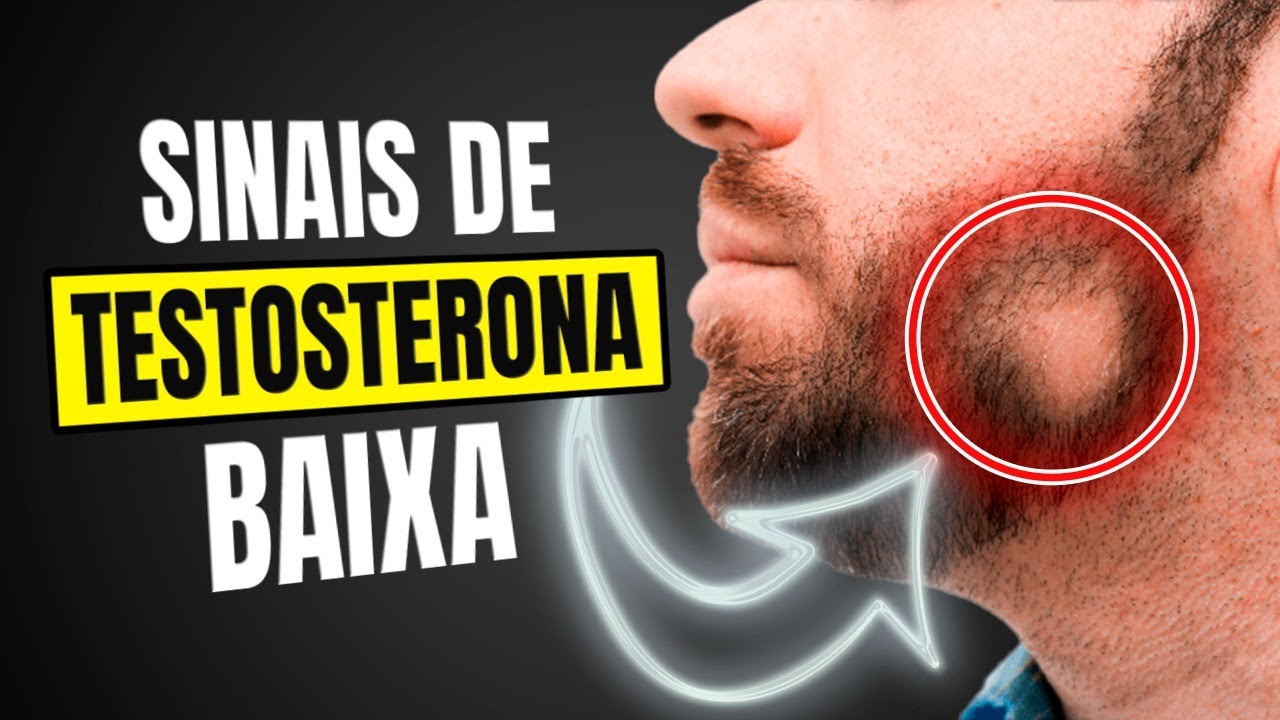 10 Sinais que sua TESTOSTERONA está baixa e que voce deve se preocupar