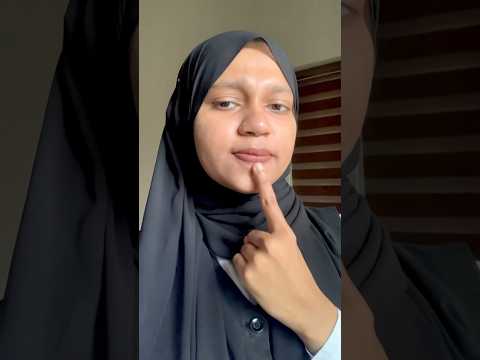 Pigmentation povan adipoli lipbalm💄🤌🏻#youtubeshorts #malayalam #wishcare