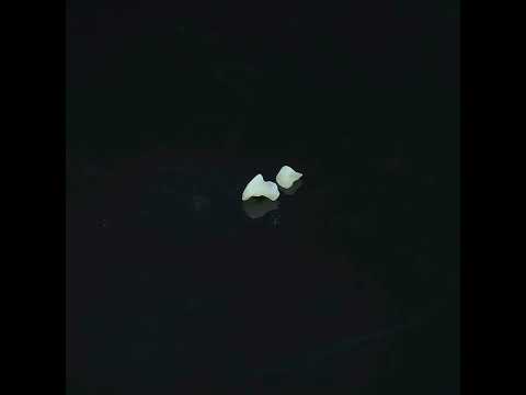 YouTube 썸네일