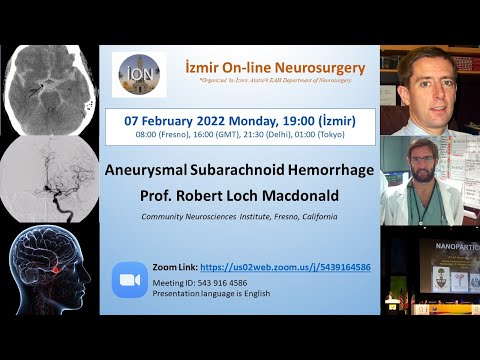 ION 206. ZOOM lecture, Macdonald:  Subarachnoid Hemorrhage 07.02.22