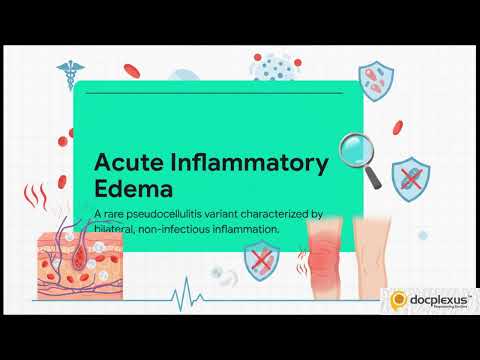 Cellulitis or Acute Inflammatory Edema? The Clues You Shouldn’t Miss