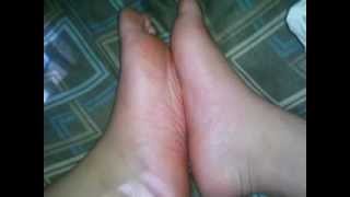 Redbone Soles