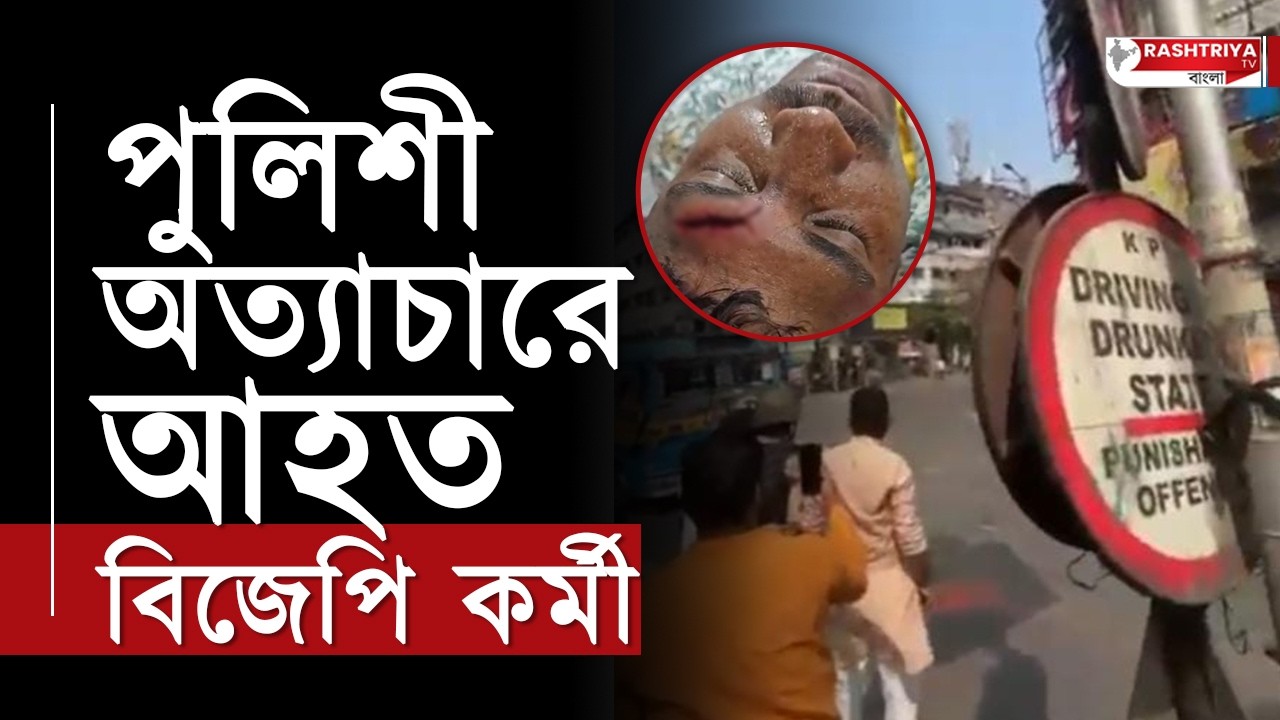 Modi Brigade Rally: ব্রিগেডে পুলিশী অত্যাচারে রক্তাক্ত বিজেপি কর্মী | BJP Brigade | BJP | BJP News