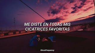 Steve Aoki - A Lover And A Memory (ft. Mike Posner) Traducida al Español