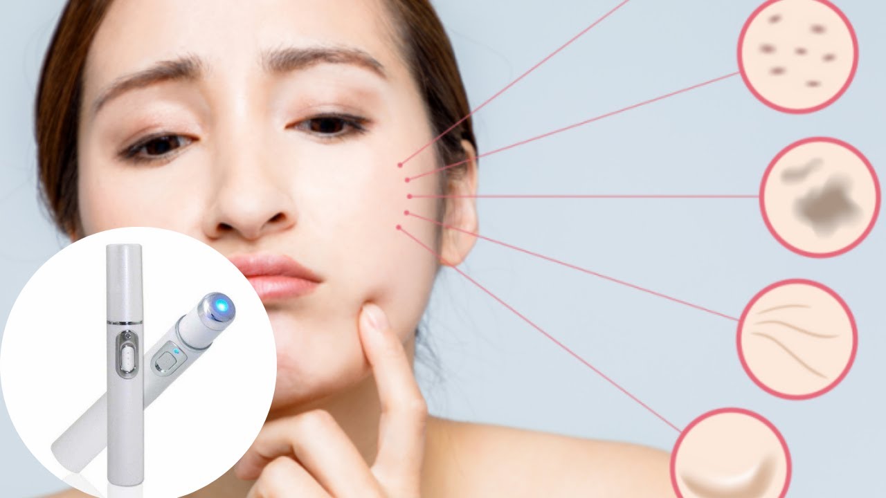 Stylo Laser Anti-Taches sur la Peau: HYPER EFFICACE !!