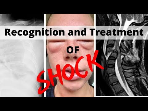 Recognition and Treatment of Shock