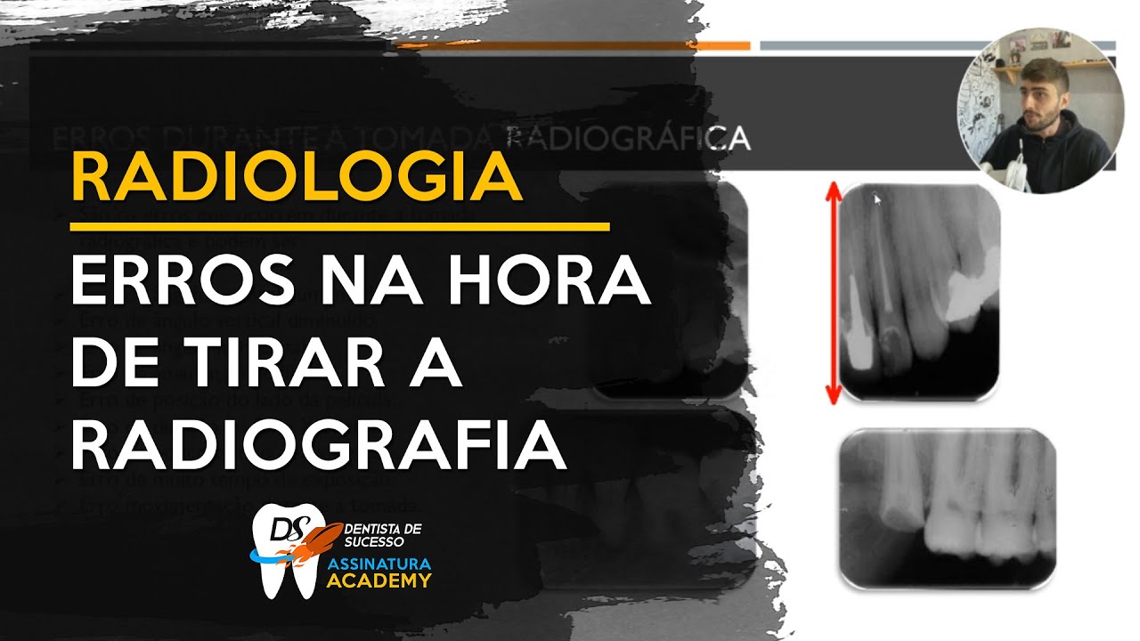 Erros na hora de tirar a radiografia | Como corrigir?