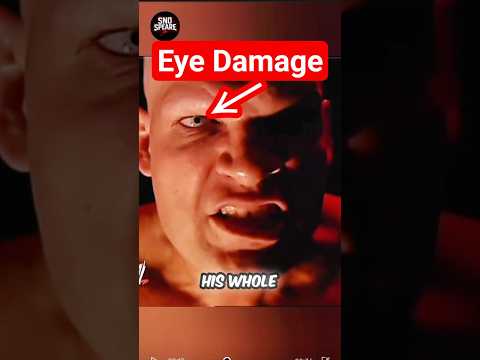 Why was Kane’s right eye damaged like this? #wwe #kane