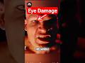 Why was Kane’s right eye damaged like this? #wwe #kane