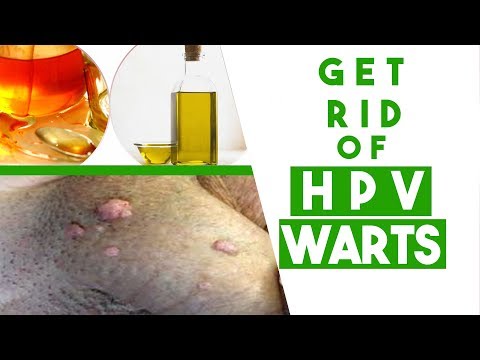 Warts from human papillomavirus