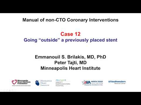 Case 12: PCI Manual: "Neoluminal" revascularization