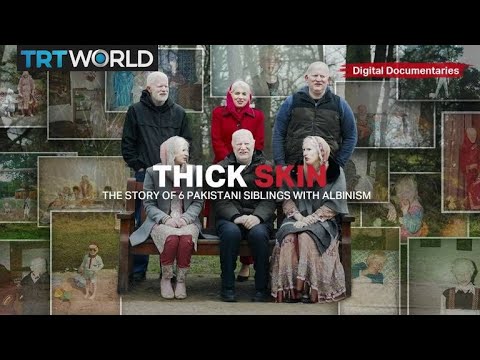 Thick Skin - The Story of 6 Pakistani Siblings with Albinism