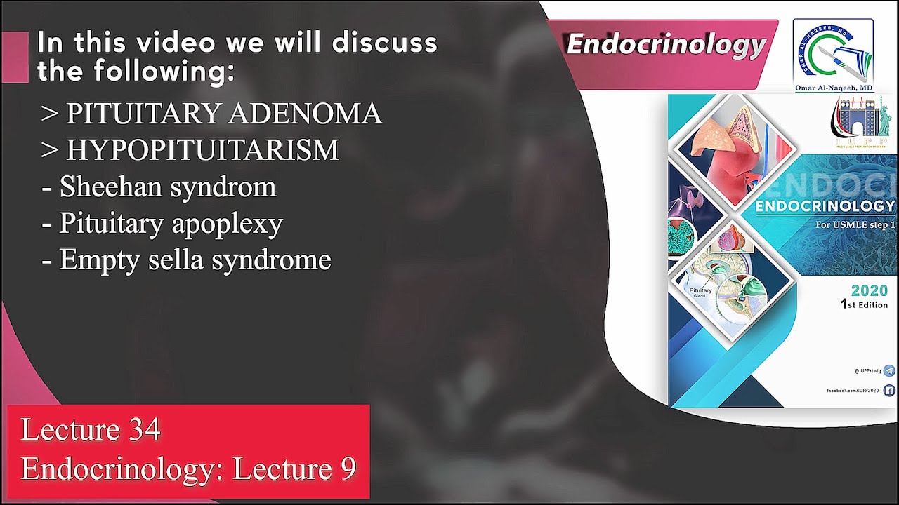 Pituitary adenoma || Sheehan syndrome