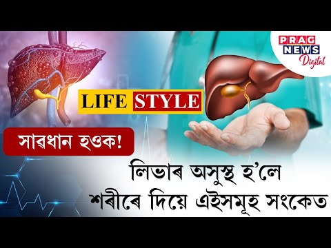 Signs and symptoms of liver damage or disease... Watch