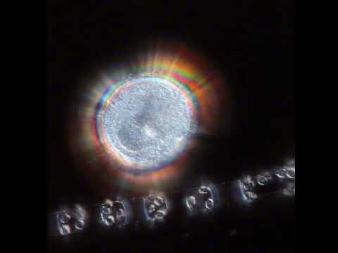 Video thumbnail for Rainbow Eye (Ugly 2018 Mix)