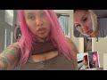 I Got Surgery In Monterrey Mexico For 300 Chin Lipo Buccal Fat Removal