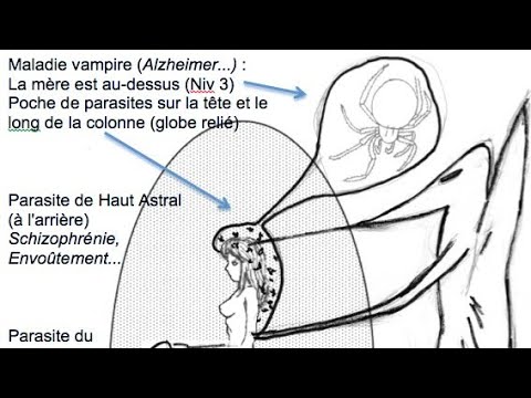 Demons: $ource of all di$ease?... (djinn, archon, morgellons, para$ites)