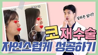 코재수술 무보정 전후 사진